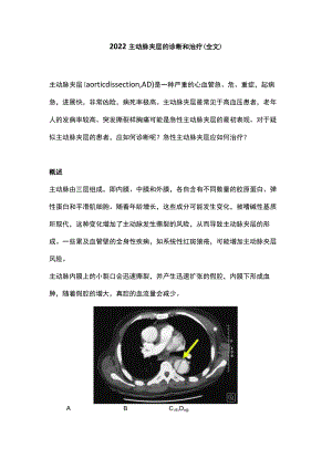 2022主动脉夹层的诊断和治疗（全文）.docx
