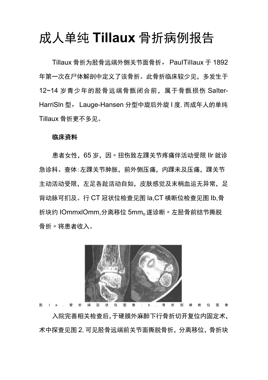 骨科医师晋升副主任(主任)医师高级职称病例分析专题报告(成人Tillaux骨折).docx_第2页
