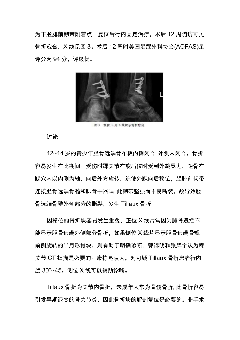 骨科医师晋升副主任(主任)医师高级职称病例分析专题报告(成人Tillaux骨折).docx_第3页