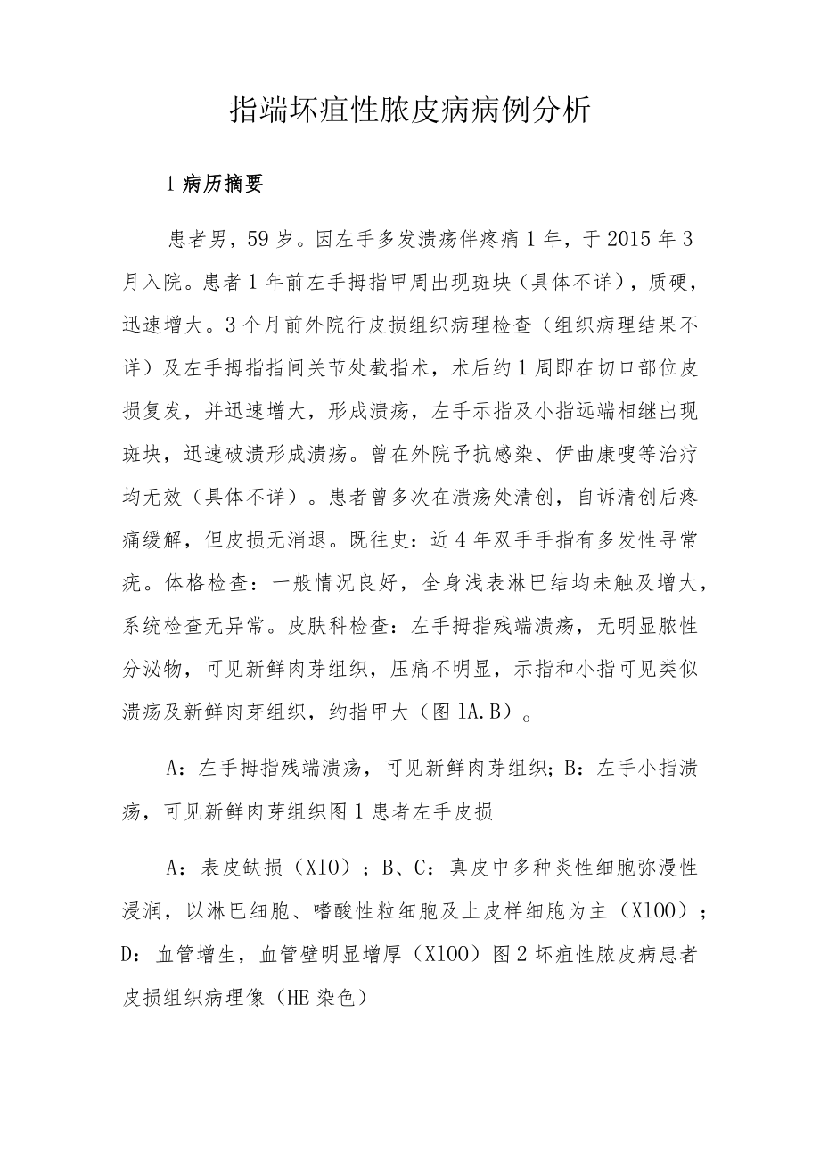 外科医师晋升副主任（主任）医师高级职称病例分析专题报告（坏疽性脓皮病）.docx_第2页