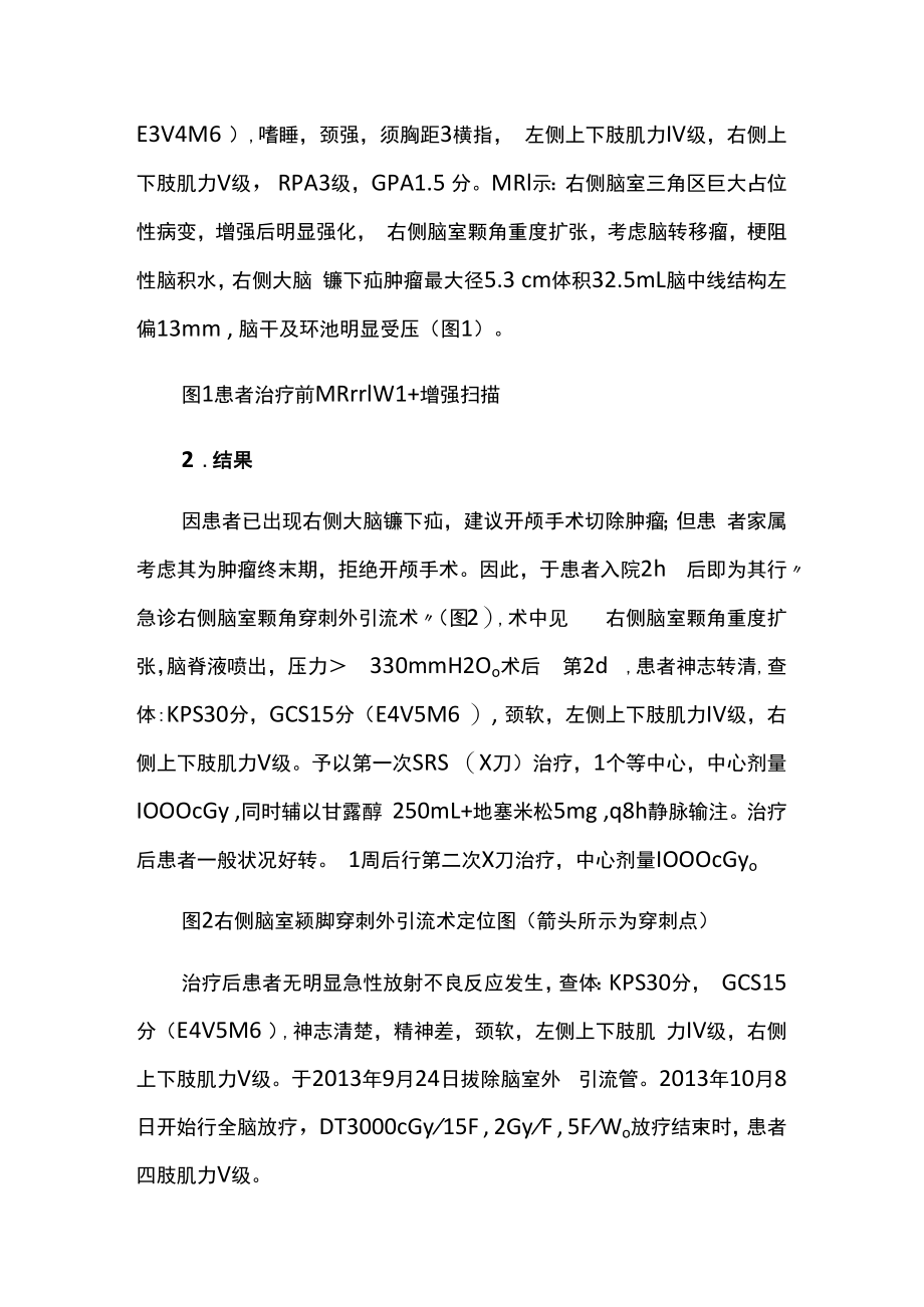 脑外科医师医师晋升副主任（主任）医师例分析专题报告（射外科治疗巨大脑转移瘤）.docx_第3页