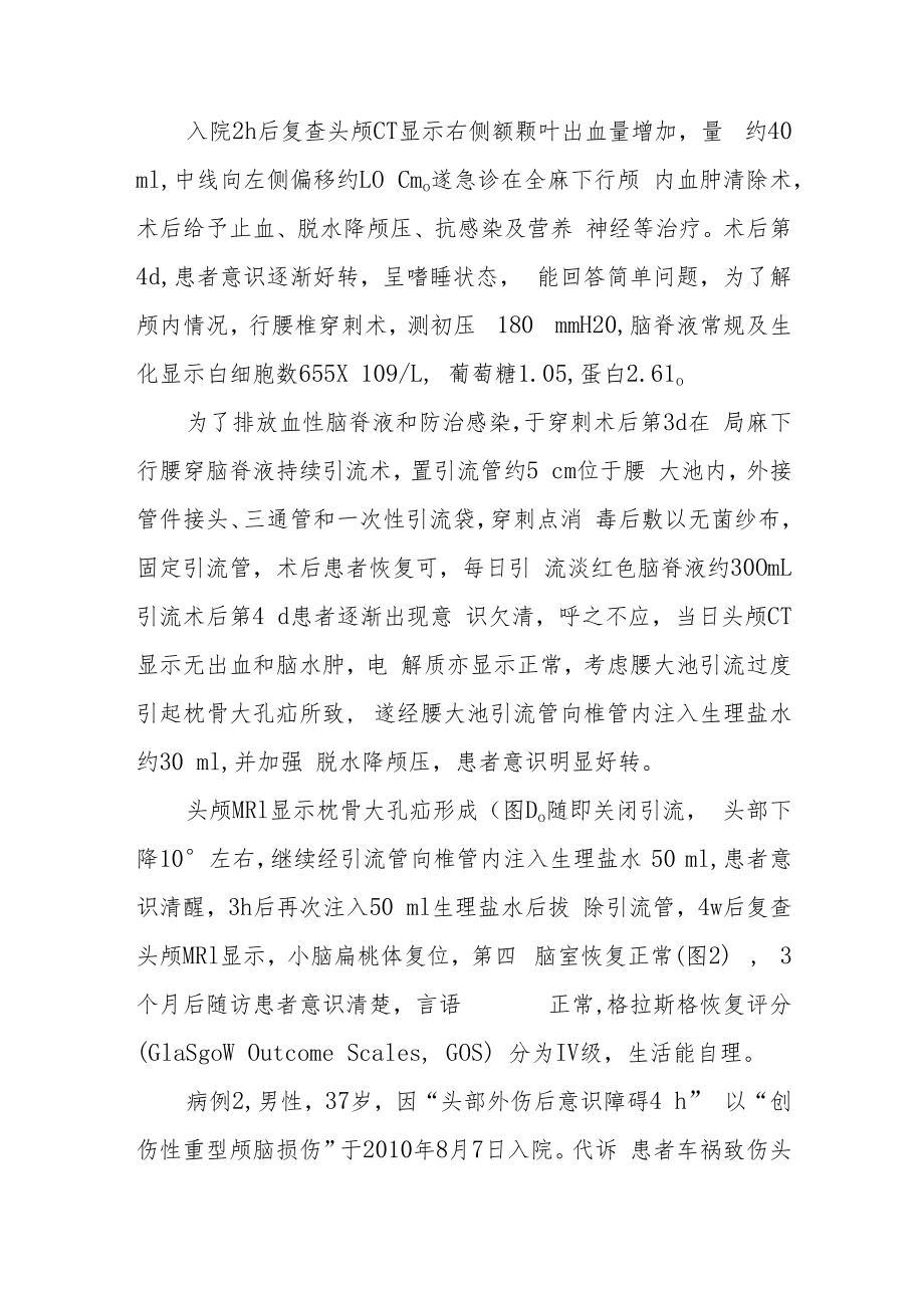 腰大池持续引流术后枕骨大孔疝病例分析专题报告.docx_第2页
