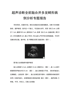 超声诊断全前脑合并多发畸形病例分析专题报告.docx