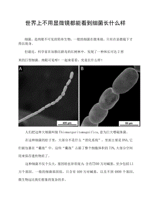 世界上不用显微镜都能看到细菌长什么样.docx