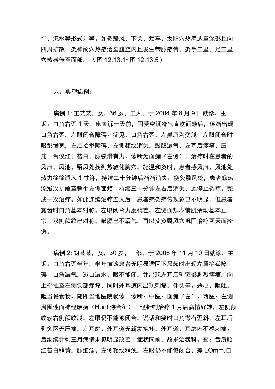 热敏灸治疗面瘫.docx_第3页