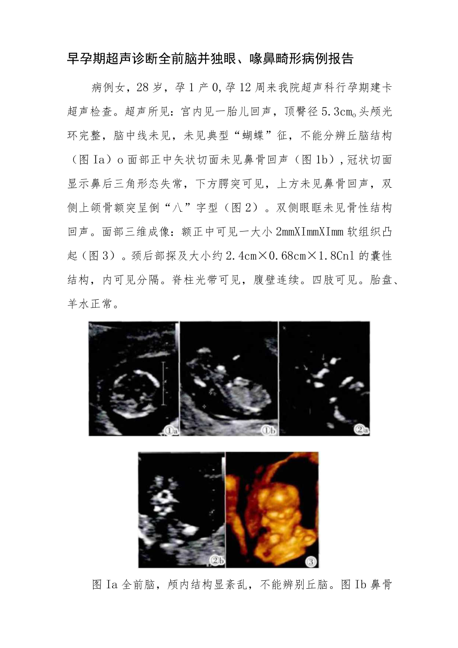 超声科晋升副高（正高）医师高级职称职称病例分析专题报告三篇.docx_第2页