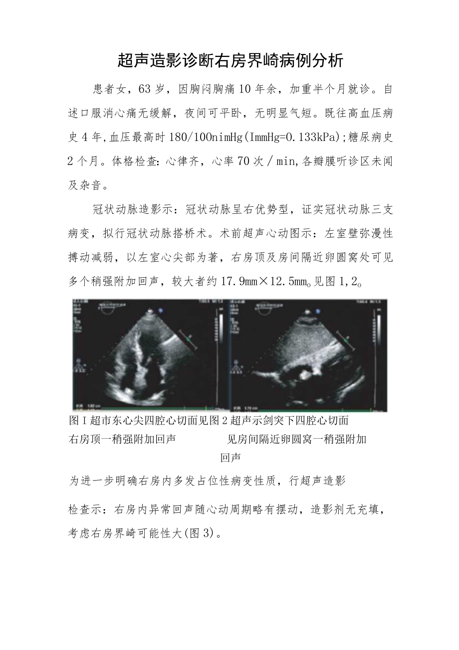 超声科医师（技师）晋升高级职称病例分析专题报告汇编三篇.docx_第2页