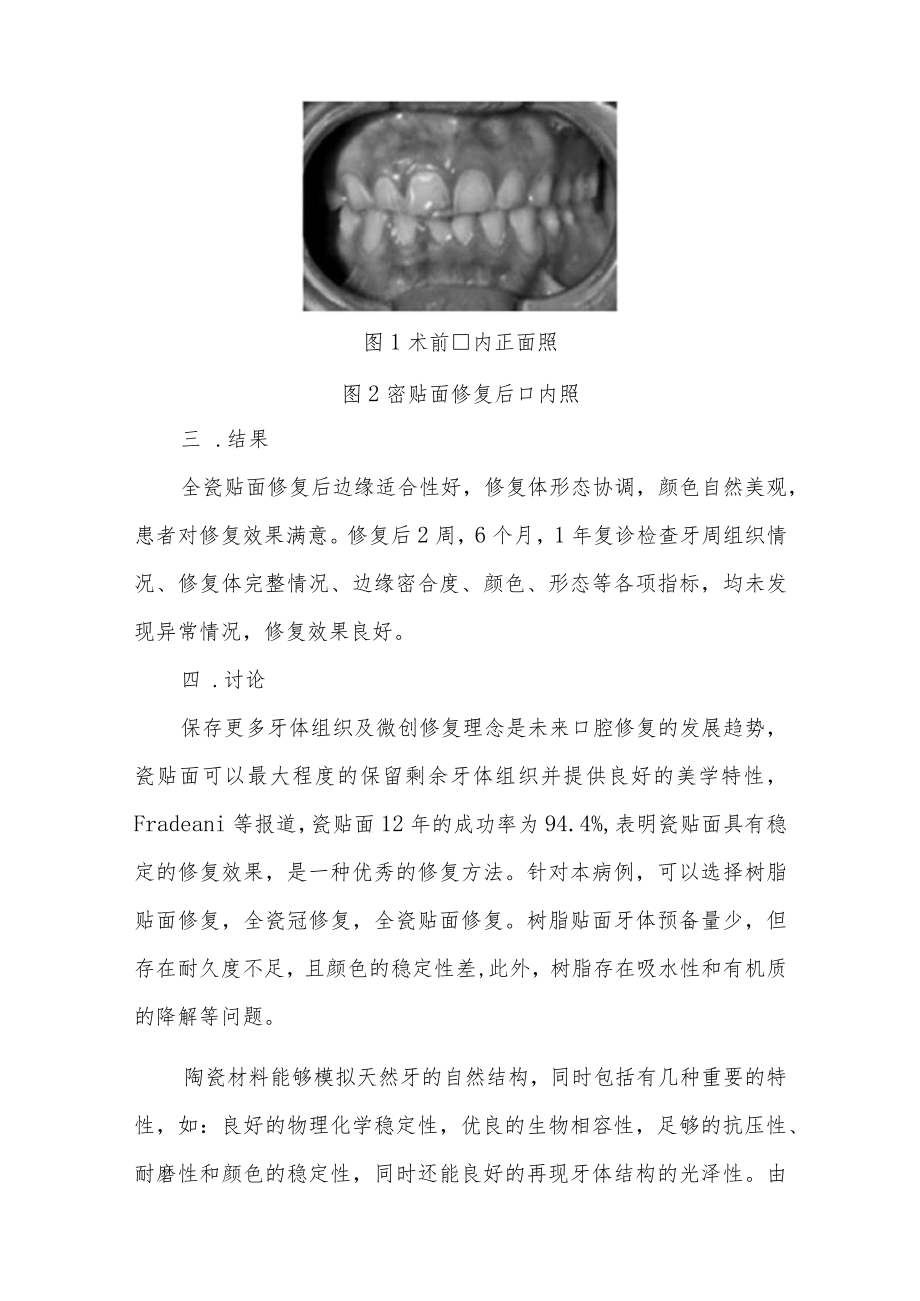 口腔科晋升副主任医师病例高级职称分析专题报告3篇汇编.docx_第3页