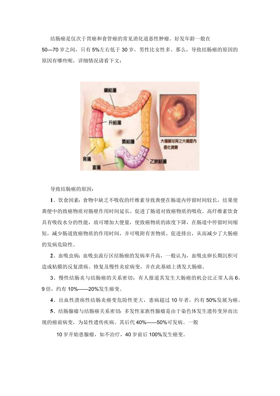 导致结肠癌的原因有哪些.docx_第1页