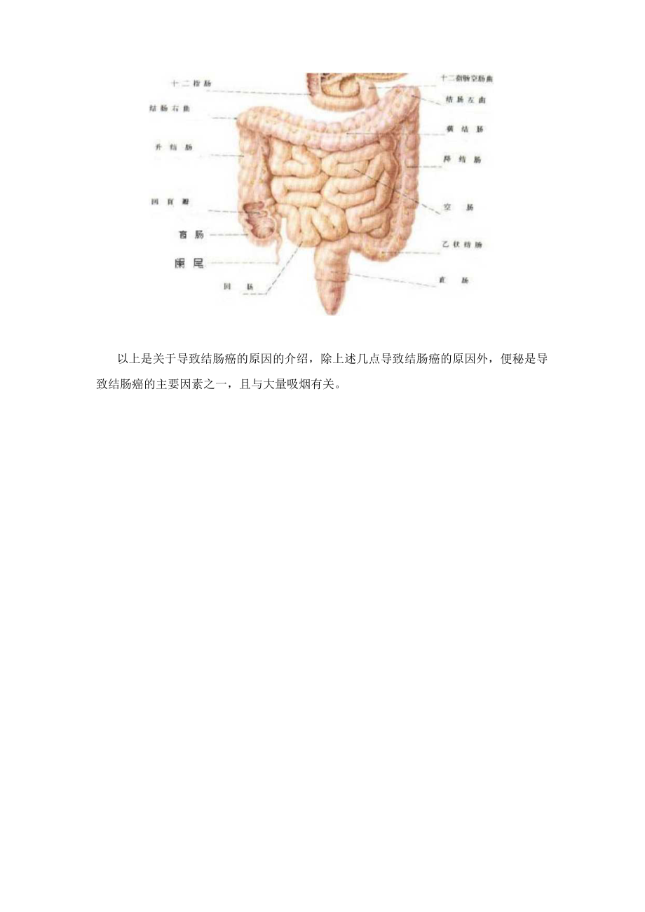 导致结肠癌的原因有哪些.docx_第2页