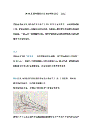2022足副舟骨综合征的诊断和治疗（全文）.docx