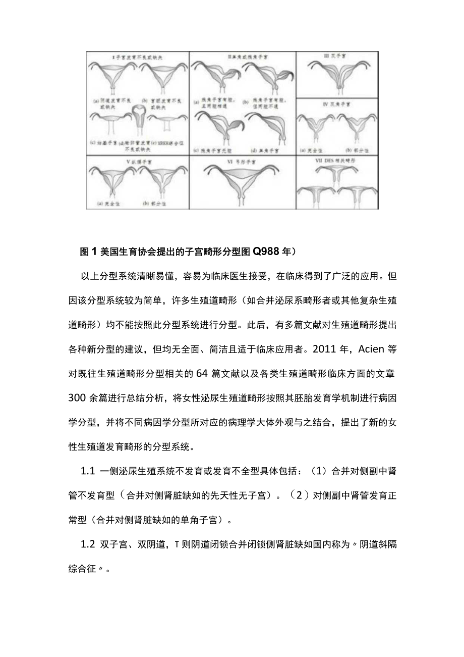 女性生殖道畸形新分类分型和现代诊治策略主要内容.docx_第3页