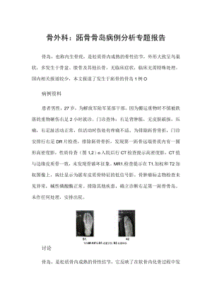 骨外科：跖骨骨岛病例分析专题报告.docx