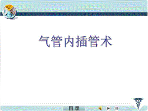 气管内插管术.ppt