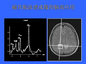 磁共振波谱成像的脑部应用.ppt