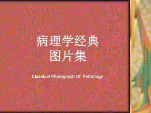 病理学经典图片集名师编辑PPT课件.ppt