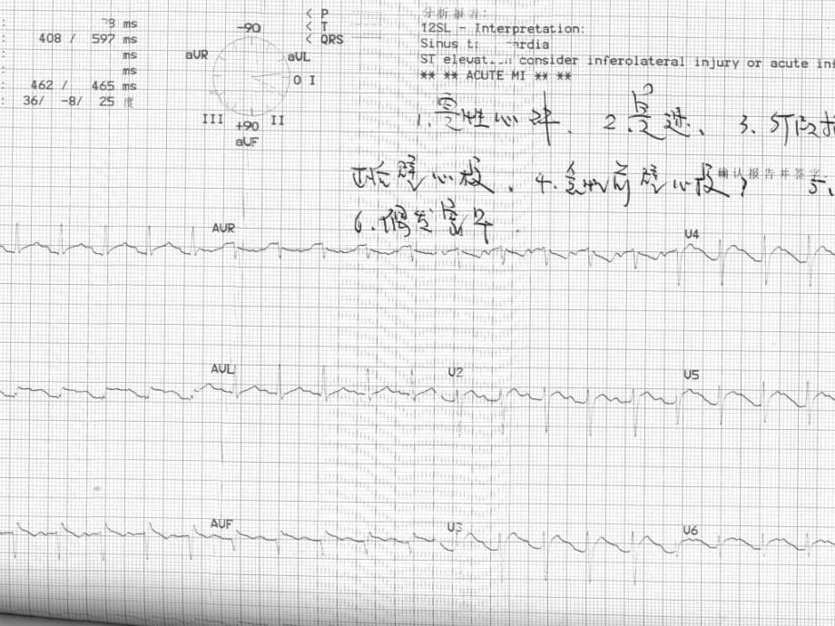 病例讨论发热胸痛原因待查名师编辑PPT课件.ppt_第3页