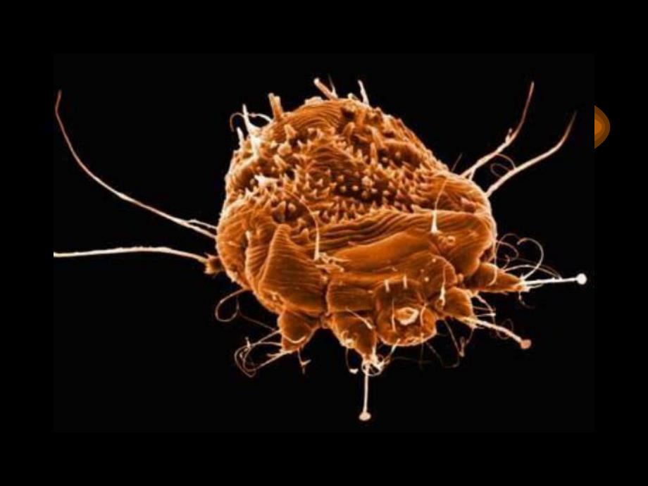 疥疮h新ppt课件.ppt_第3页