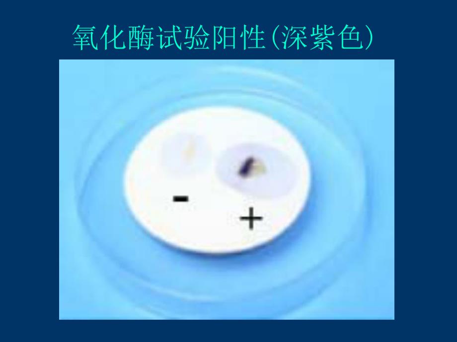 第11章弧菌.ppt_第3页