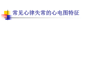 常见心律失常的心.ppt