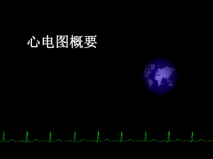 心电图入门精要.ppt
