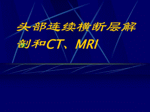 头部连续横断层解剖及CT、MRI名师编辑PPT课件.ppt