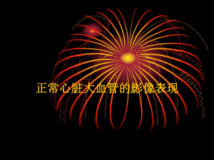 心脏大血管的影像表现名师编辑PPT课件.ppt
