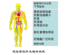 急性重症肝炎临床表现名师编辑PPT课件.ppt