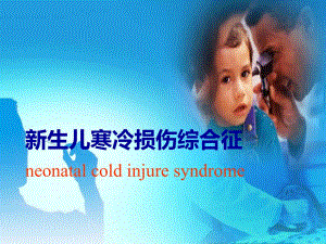 新生儿寒冷损伤综合征ppt.ppt