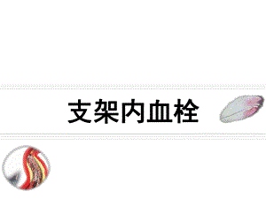 支架内血栓.ppt