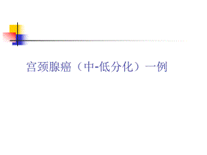 宫颈腺癌中低分化.ppt