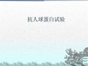 抗人球蛋白试验.ppt