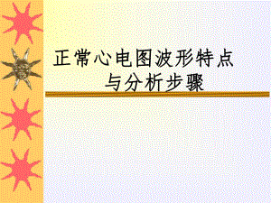 正常心电图解读.ppt