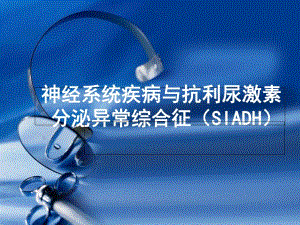 抗利尿激素分泌异常综合征.ppt