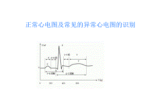 正常心电图及常见的异常心电图的识别.ppt