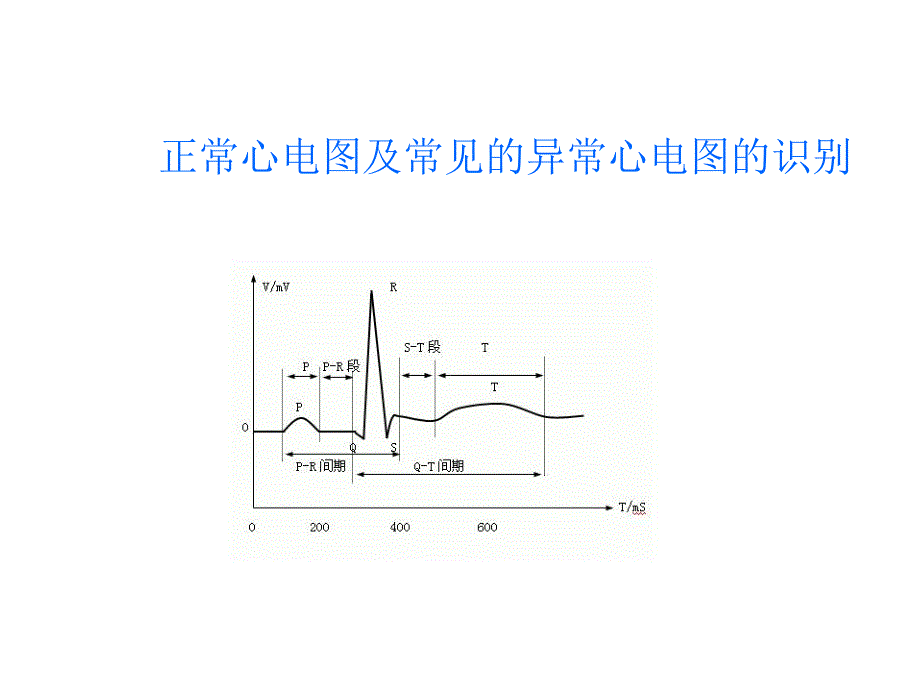 正常心电图及常见的异常心电图的识别.ppt_第1页