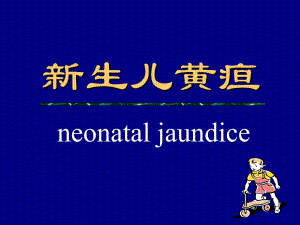 新生儿黄疸本科生名师编辑PPT课件.ppt