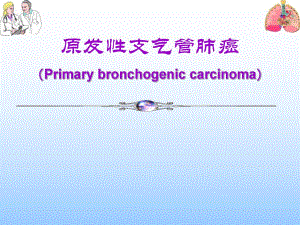 原发性支气管肺癌1名师编辑PPT课件.ppt