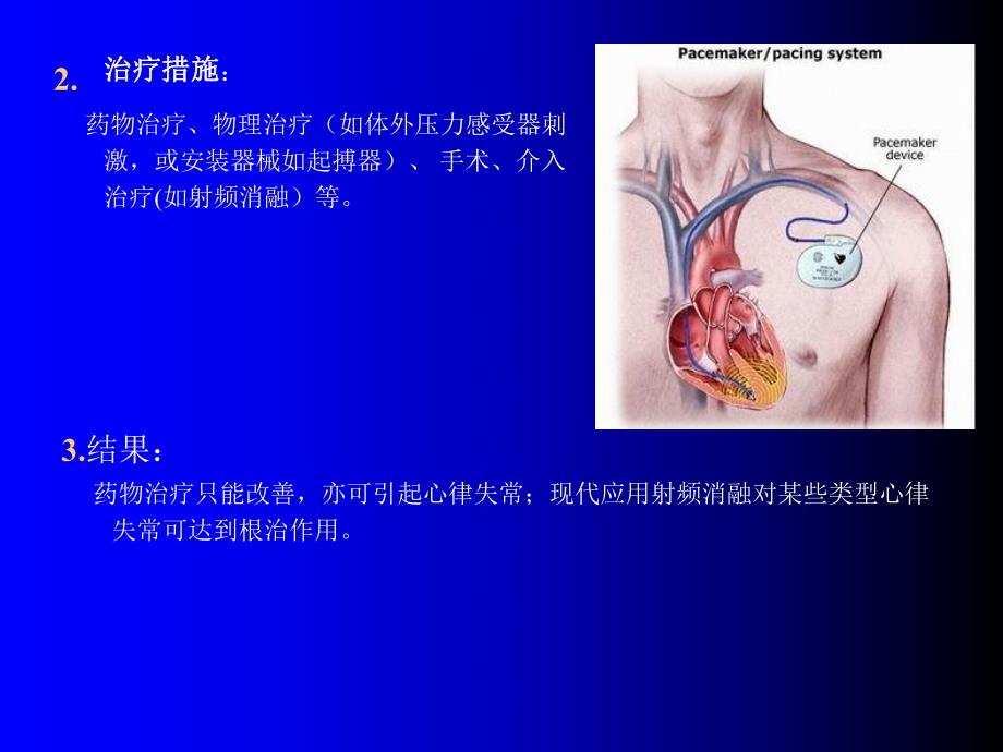 第22章抗心律失常药名师编辑PPT课件.ppt_第3页