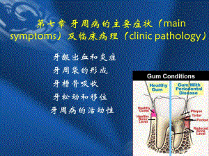 第七章牙周病的主要症状.ppt