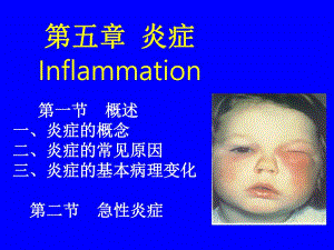 第七次课第五章炎症1.ppt