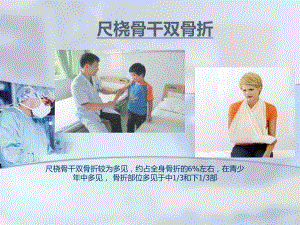 尺桡骨干双骨折.ppt