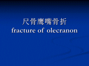 尺骨鹰嘴骨折.ppt