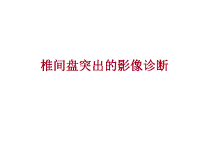 椎间盘突出的影像表现.ppt