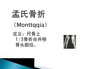 孟氏骨折与盖氏骨折.ppt.ppt