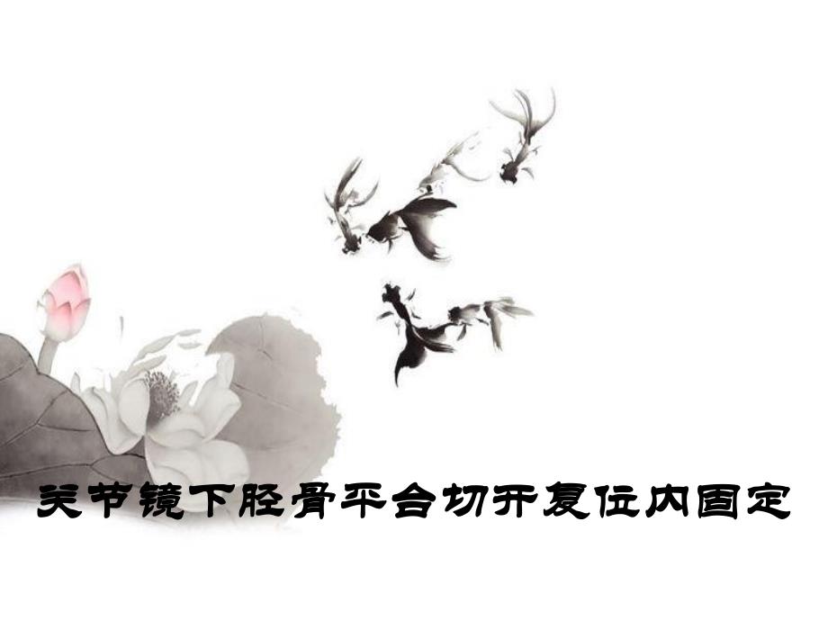 胫骨平台骨折治疗分型.ppt_第1页