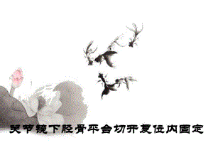 胫骨平台骨折治疗分型.ppt