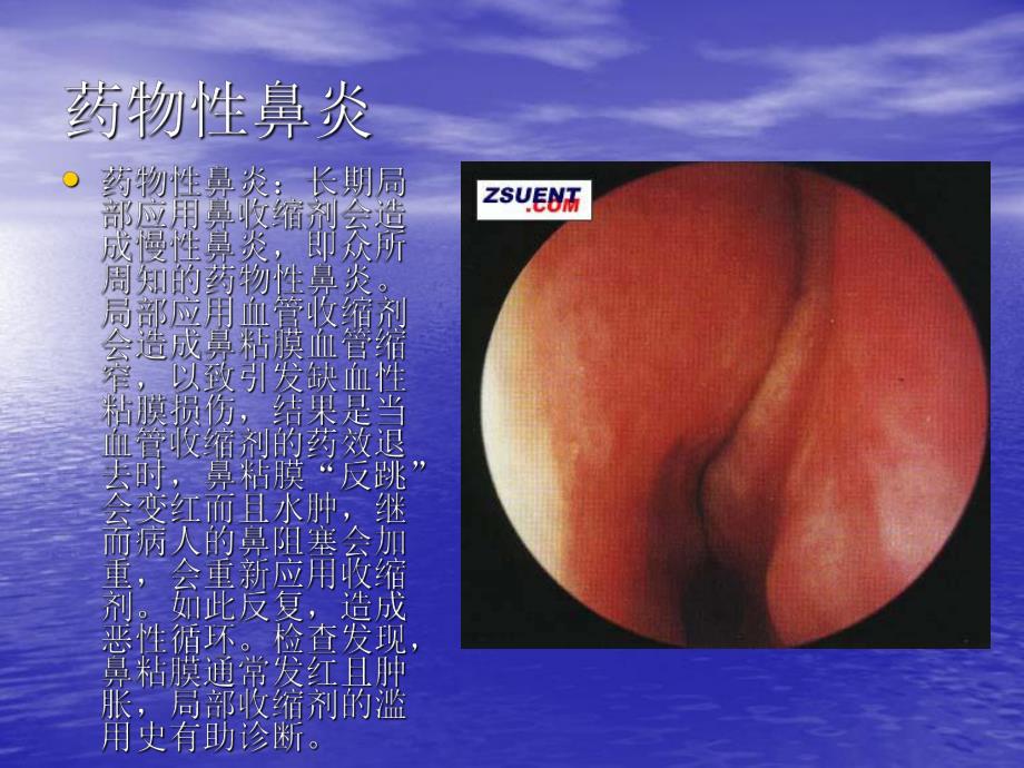 鼻的解剖图及手术图.ppt_第3页