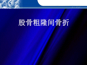 股骨粗隆间骨折.ppt