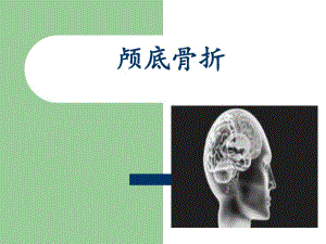 颅底骨折.ppt